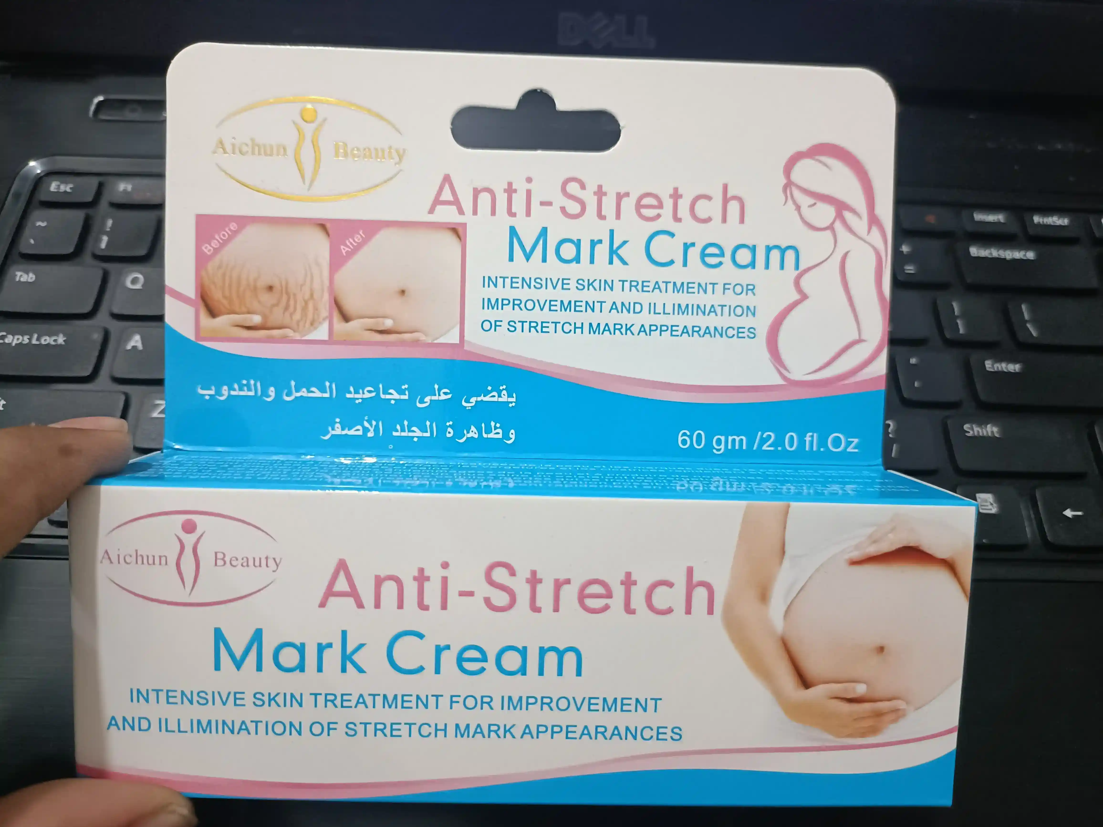 anti stretch mark cream (60gm)